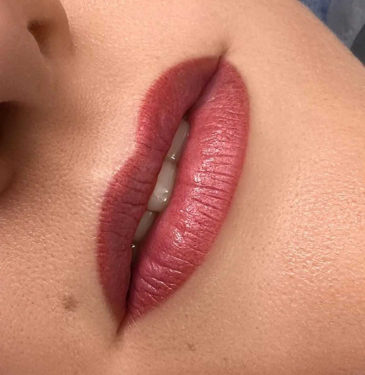 Natural Appearance